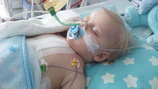 Od urodzenia walczy o życie. Potrzebna kolejna operacja dla 2-latka. Możemy pomóc