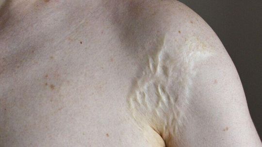 Ogień w roli głównej. Zaproszenie na wernisaż w Ratuszu