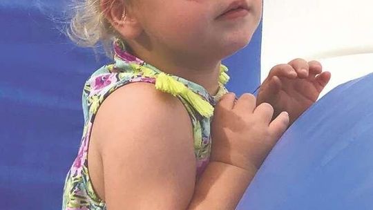 Operacja się udała, ale 3,5-letnia Ela miała zawał. Cierpi na niezwykle rzadką chorobę