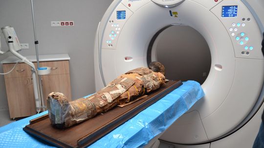 Pacjent ma 2 tysiące lat. Lubelscy lekarze „prześwietlili” egipską mumię