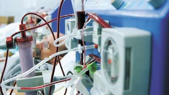 Pielęgniarka źle podłączyła "sztuczną nerkę"? Mężczyzna wykrwawił się i zmarł