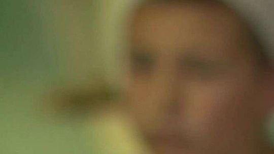 Pies odgryzł ucho 9-latkowi. Lekarze je odtworzą w nietypowy sposób