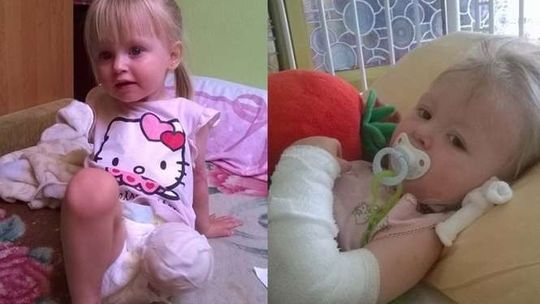 Pijany kierowca wjechał w dzieci. 2-letnia Natalka straciła nogę. Możemy jej pomóc