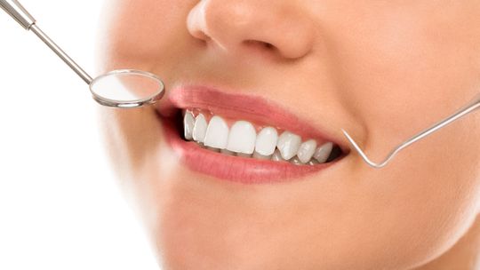 Plomby stomatologiczne - kiedy trzeba odbudować ząb i jak uzyskać naturalny efekt?