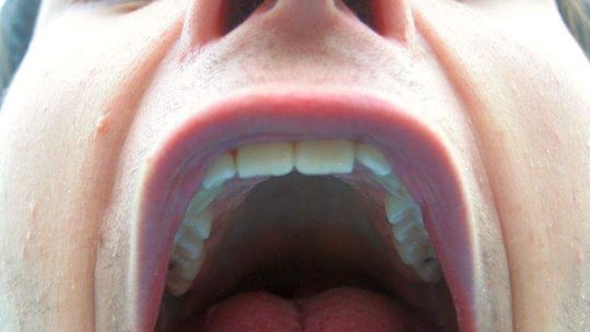 Podszedł do stolika i ugryzł mężczyznę w ucho. Lekarze musieli je zszyć