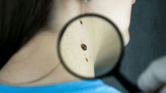 Potrzebny dermatolog? Sprawdź kogo polecają zadowoleni pacjenci