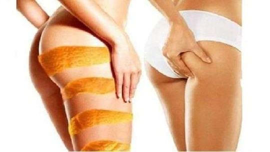 Proste i skuteczne sposoby na cellulit