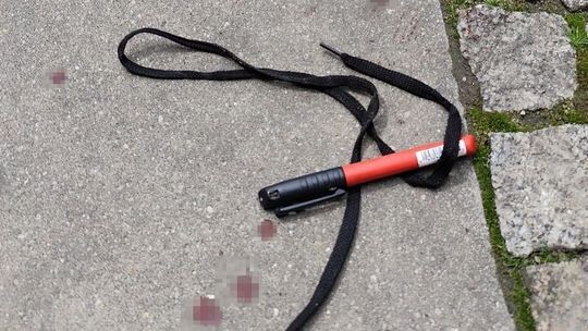 Prowizoryczny opatrunek uratował życie 20-latki