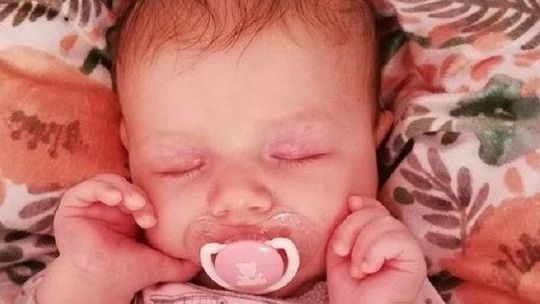 "Przez dwa miesiące choroba zrobiła u córki ogromne spustoszenie". Pomóżmy małej Zosi