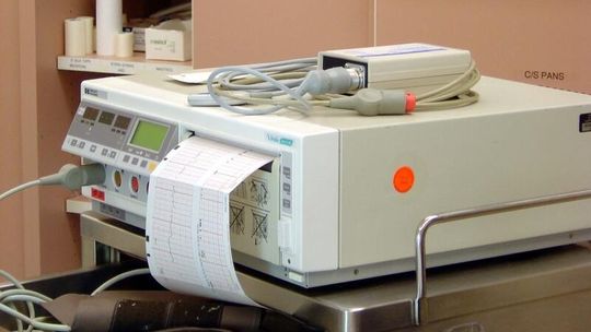 Przyjdź na bezpłatne badania EKG