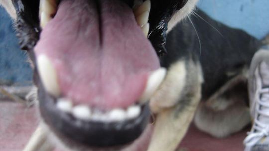 Psy pogryzły 9-latka. Dziecko ma poranione obie nogi