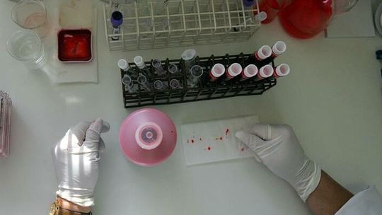 Puławy: Potwierdzono wirusa AH1N1 u mieszkańca Lipska