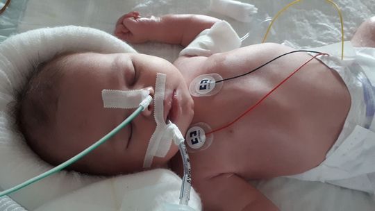 Rodzice Elizy zbierają na jej leczenie. Walczą też o zadośćuczynienie od szpitala w Parczewie