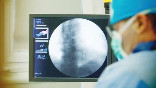 Rozrusznik serca wielkości kapsułki. Trzy pierwsze operacje w Lublinie