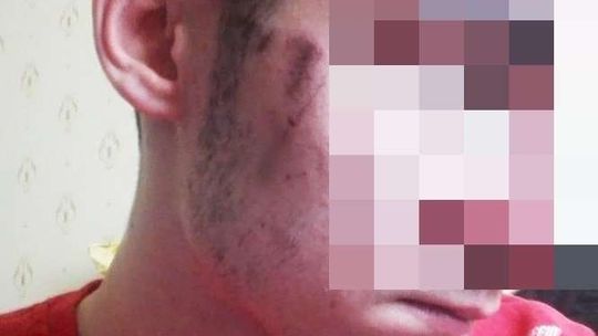 "Sam spowodował u siebie obrażenia". Śledztwo umorzone
