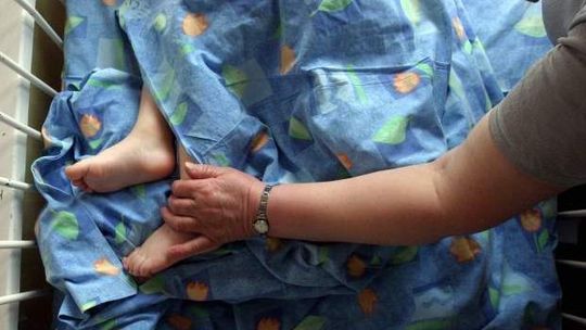 Specjalistyczny oddział leczenia oparzeń u dzieci powstał w Łęcznej