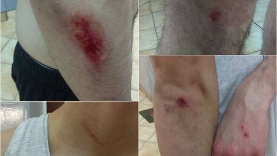 Student Politechniki Lubelskiej z Turcji pobity koło baru przy ul. Nadbystrzyckiej. "Padłem ofiarą rasistowskiej napaści"