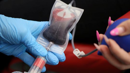 Styczniowe poszukiwanie dawców. Pierwsze już w tę niedzielę