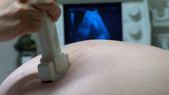 Surogatki: Wynajmę brzuch na 9 miesięcy