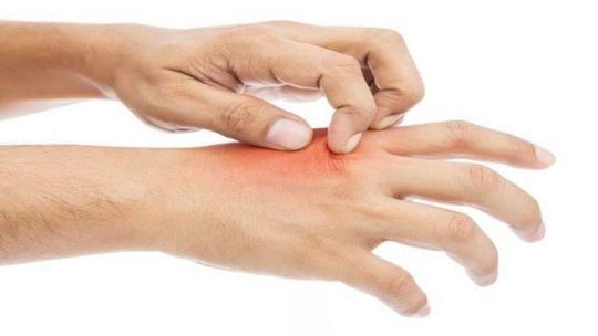 Świerzb, co musisz o nim wiedzieć?