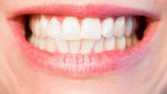 Szczoteczka elektryczna – czy to się opłaca?