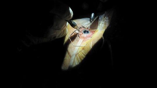 Szereg nieprawidłowości w szpitalu przy al. Kraśnickiej w Lublinie. Pacjenci po operacji zarazili się gronkowcem