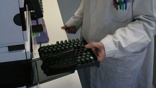 Szpitale coraz częściej korzystają z zewnętrznych laboratoriów. "Wyniki są bardzo często zafałszowane"