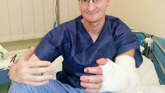 To niesamowite uczucie mieć obie dłonie. Rozmowa z mieszkańcem Zamościa