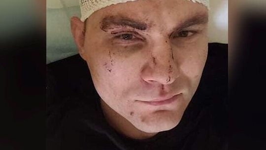 To oni napadli na piosenkarza disco polo. Jeden miał toporo-młotek