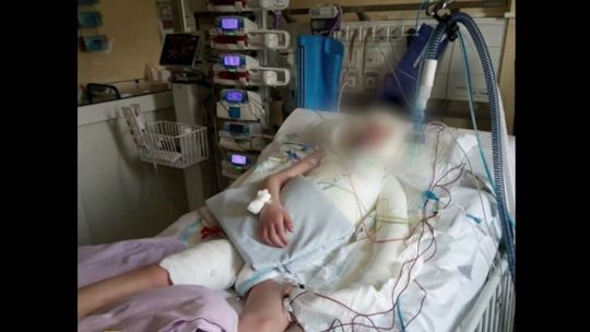 Tragedia. Skatowany przez ojczyma 8-latek nie żyje