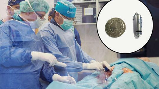 W Lublinie wszczepili najmniejsze na świecie stymulatory serca