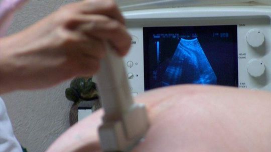 W Puławach będą rodzić po ludzku. Remont w szpitalu