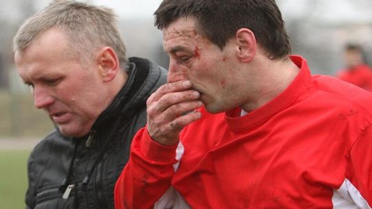 Walka, krew i złamany nos w meczu czwartej ligi