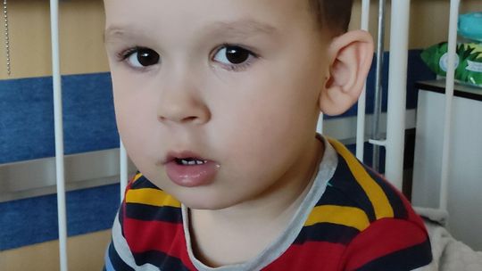 Walka o zdrowie 3-letniego Leona z Lublina. "Grozi mu operacja, jeżeli nic nie zrobimy ze skoliozą"