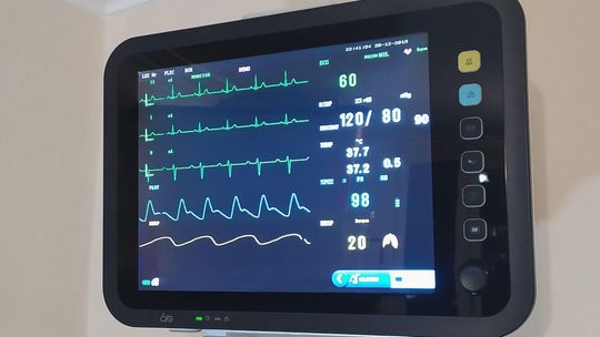 WOŚP kupiła 157 kardiomonitorów w ramach walki z epidemią