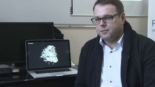 Wydrukował serce swojemu synkowi. Teraz pomaga innym dzieciom