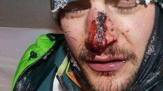 Wyprawa na K2. Adam Bielecki miał wypadek