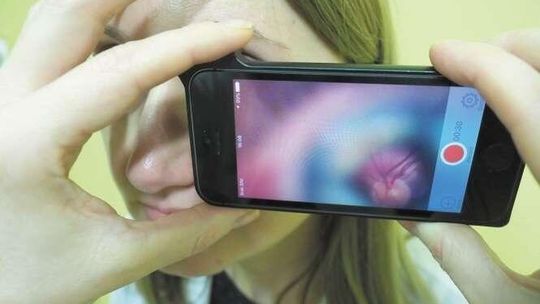 Wzrok będzie można badać telefonem? Lubelscy okuliści testują nową metodę