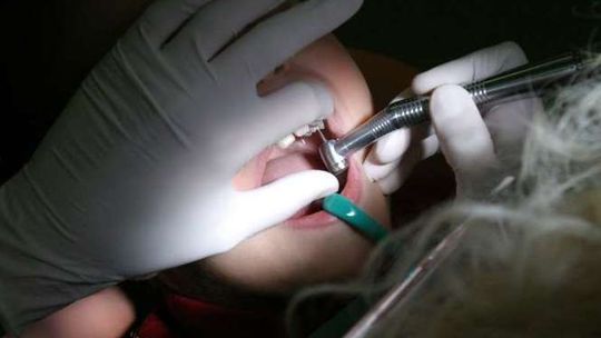 Zabrali dzieciom dentystę. Dlaczego szkolny gabinet stracił kontrakt?