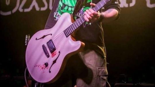 Znany polski muzyk spadł ze sceny. 5 złamanych żeber