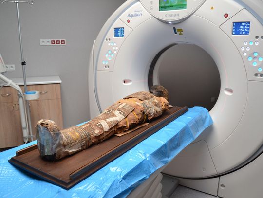 Pacjent ma 2 tysiące lat. Lubelscy lekarze „prześwietlili” egipską mumię