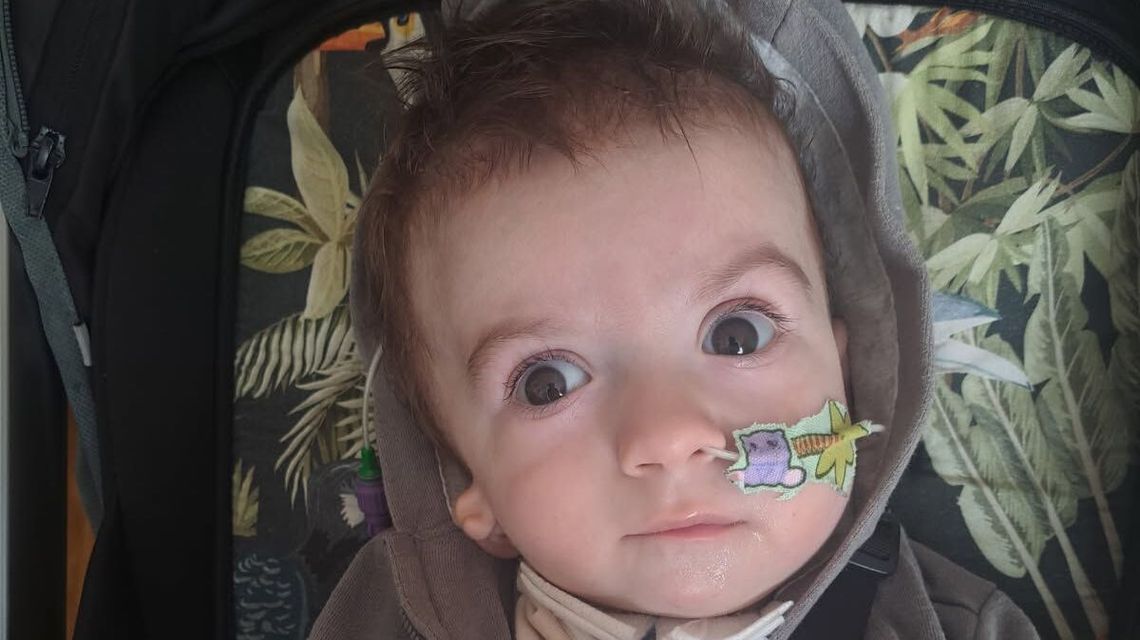 13-miesięczny Olek z Jastkowa przeszedł już pięć operacji. Potrzebne wsparcie