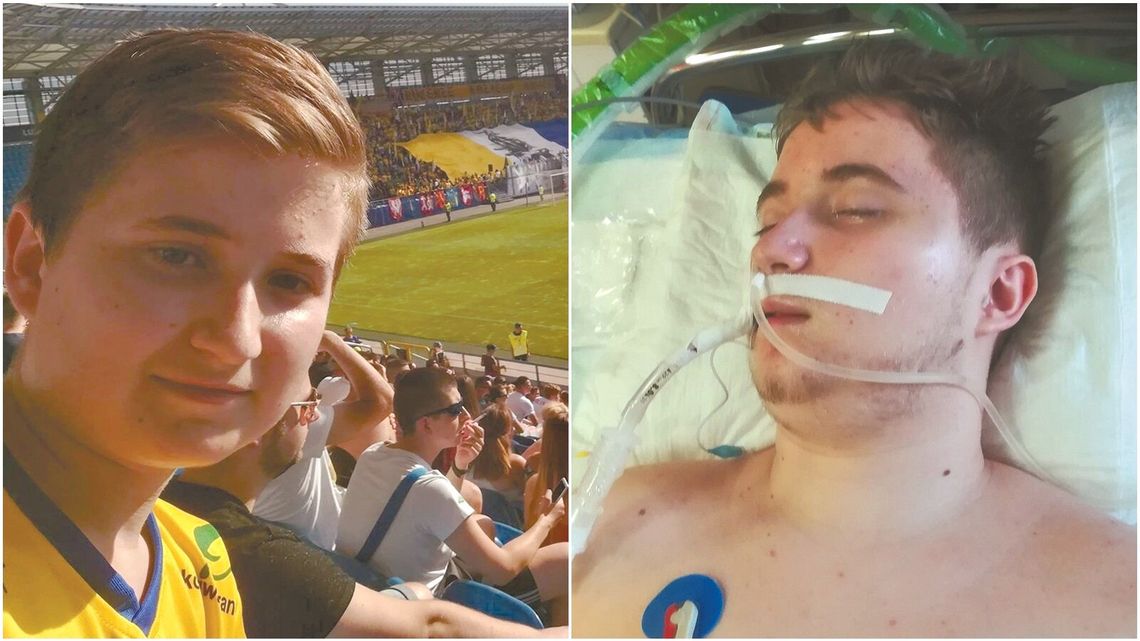 16-latek z Lublina w śpiączce po potrąceniu na przejściu. Mama ma tylko jedno marzenie