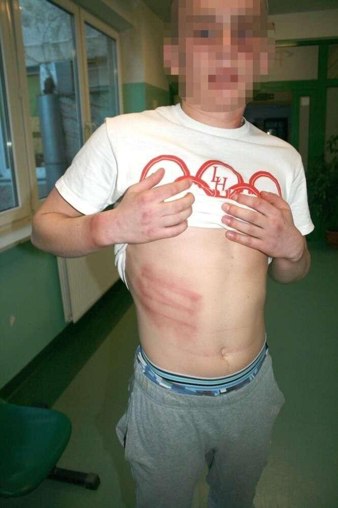 18-latek: Pobili mnie policjanci. Policja: Był agresywny, sam uderzył się w głowę