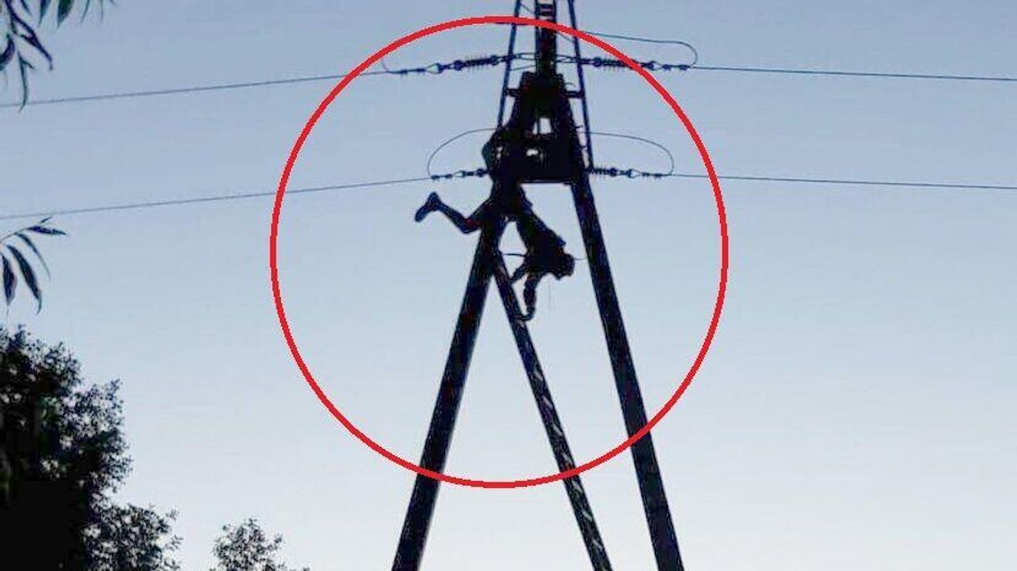 19-latek wszedł na słup energetyczny dla dziewczyny. Poraził go prąd