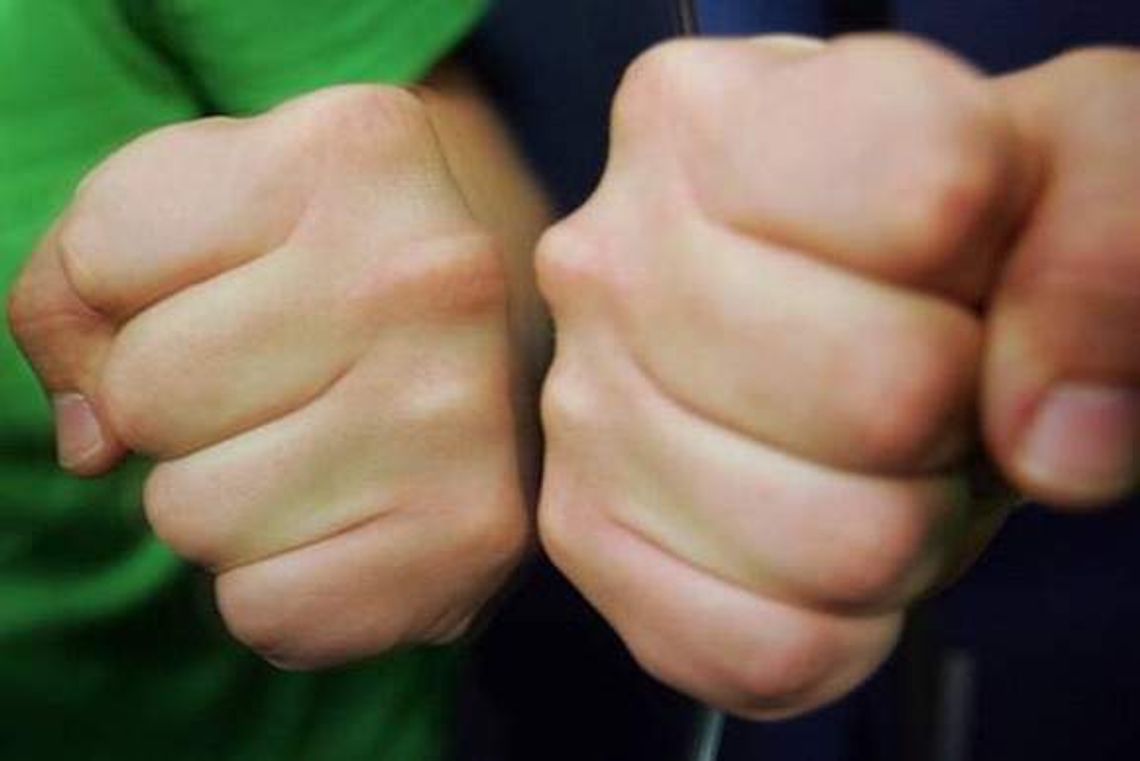 21-latek kopnął w twarz 16-latka i zaczął uciekać 21-latek kopnął w twarz 16-latka i zaczął uciekać