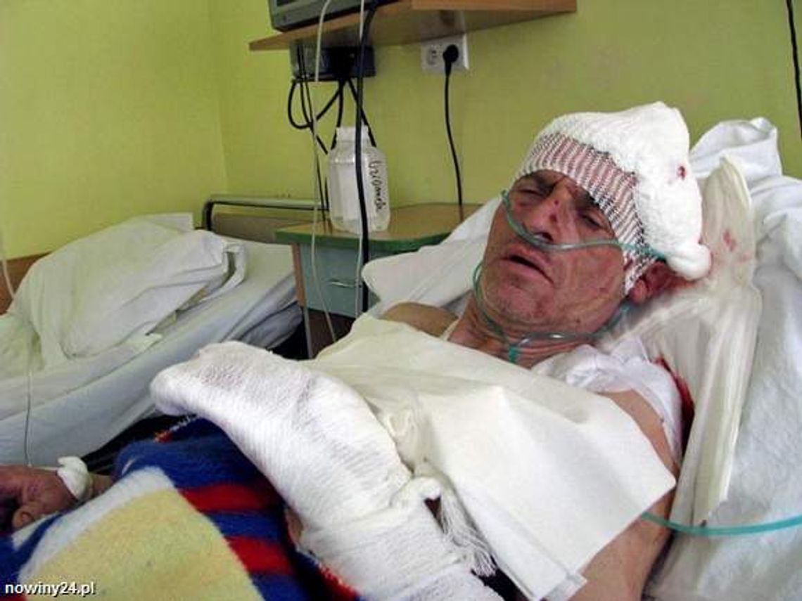54-latek z Bieszczad przeżył atak niedźwiedzia