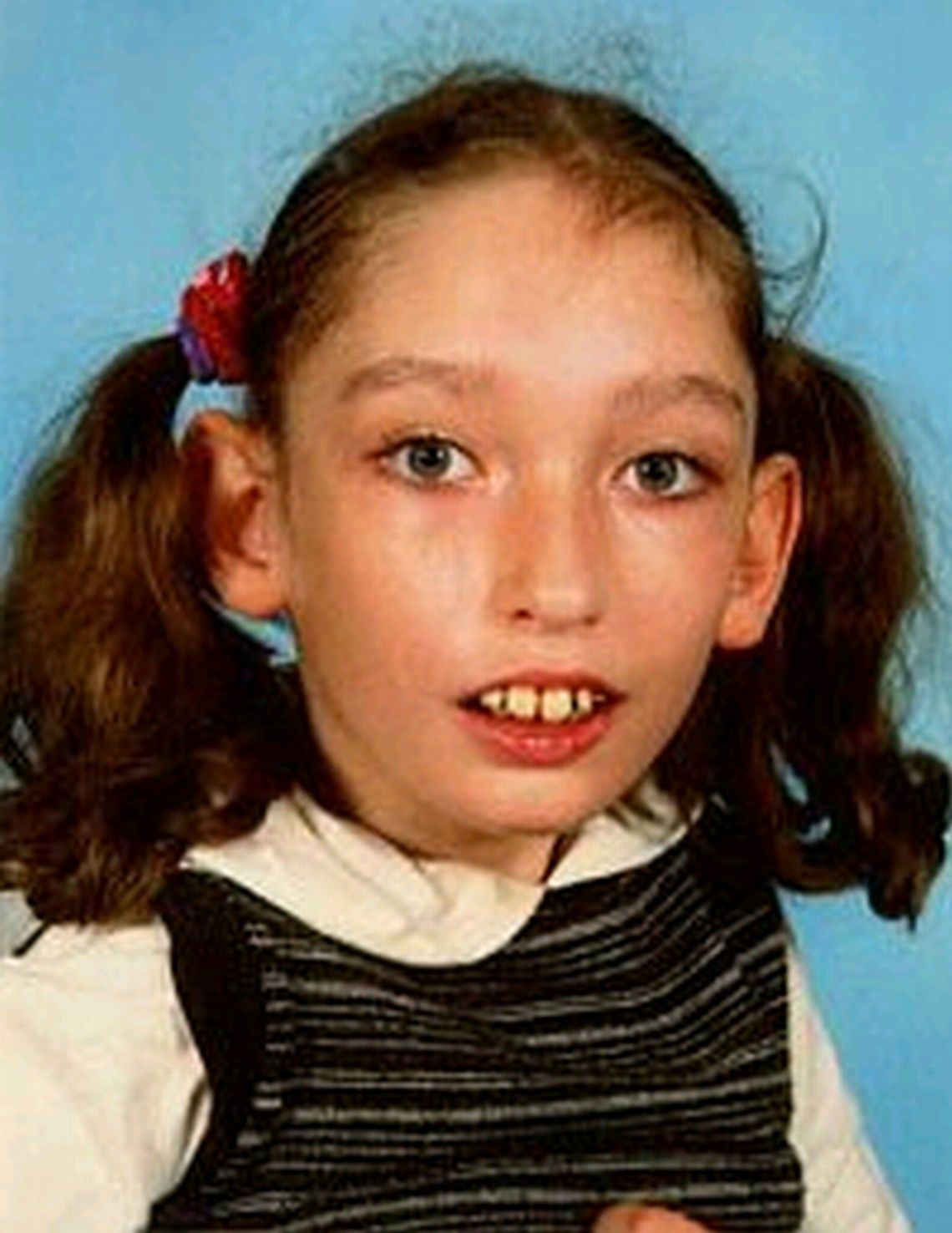 Ania nie chodzi i nie mówi. Możesz pomóc w jej rehabilitacji 