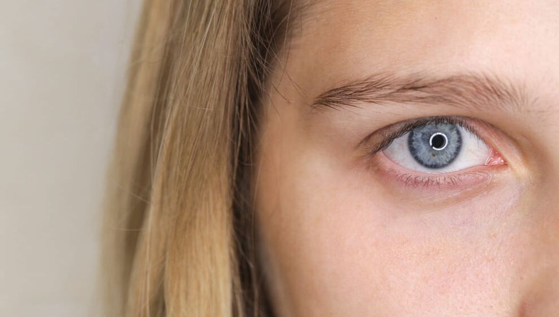 Astygmatyzm a stożek rogówki – czym się różnią i co je łączy?