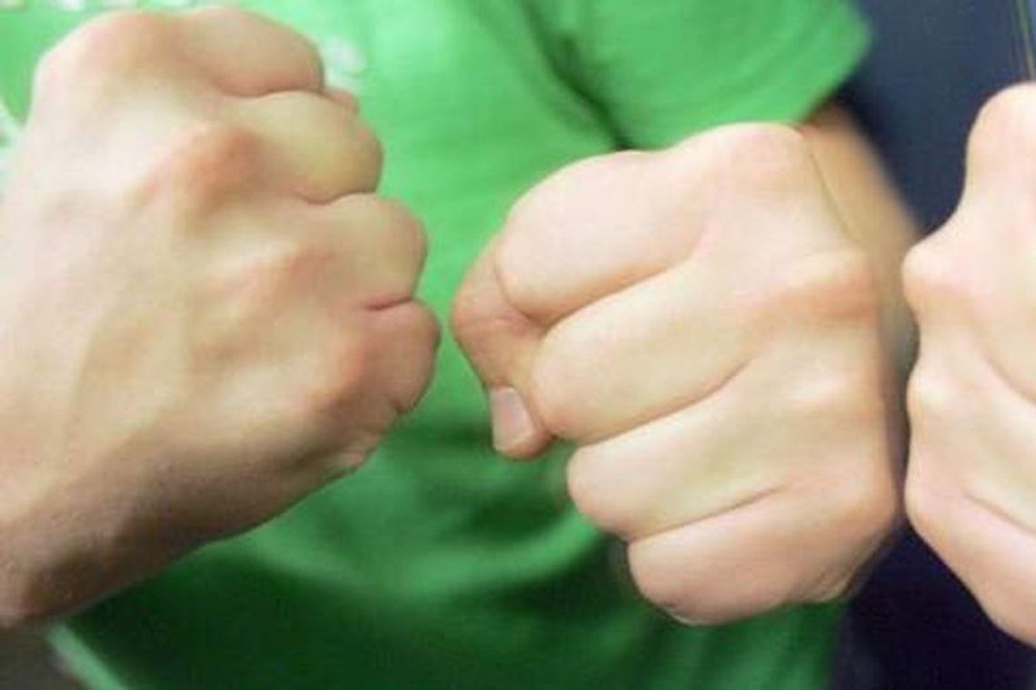 Brutalnie pobili 20-latka. Poszło o spadek